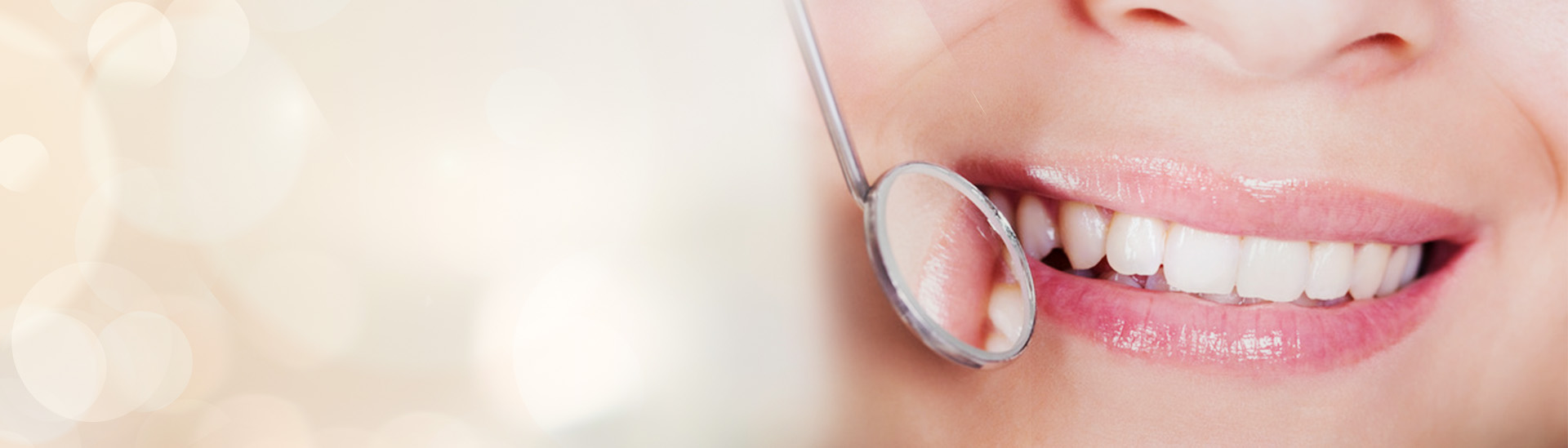 Professzionális fogtömések